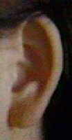 menorrhagia ear